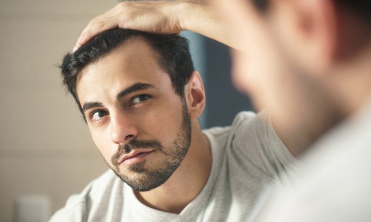 Men’s Hair Loss: Treatments and Solutions